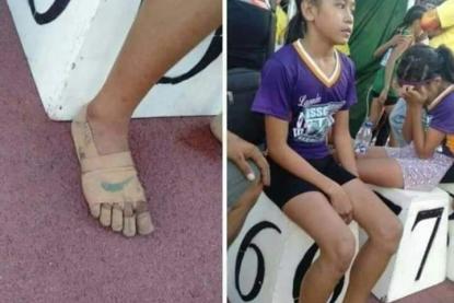 رغم عجزها عن شراء حذاء رياضي للمشاركة في السباق الطفلة ريا بلوس تفوز بثلاث ميداليات ذهبية